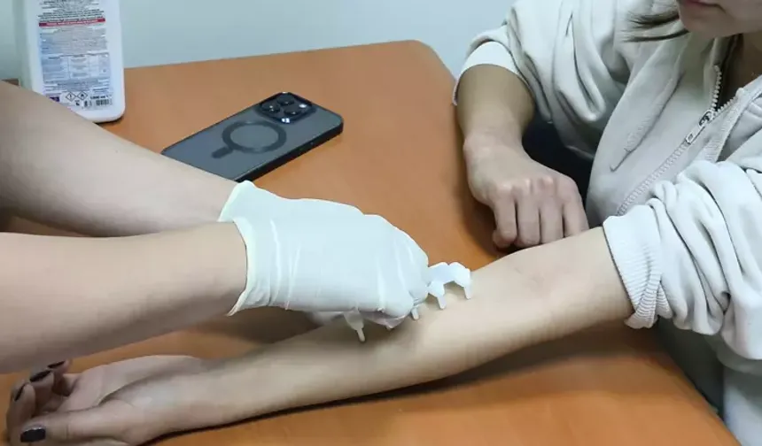 Artan Polen Yoğunluğu Nedeniyle Uzmanlar Uyardı