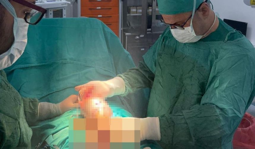 20 Santimetrelik Tümörle Yaşadı