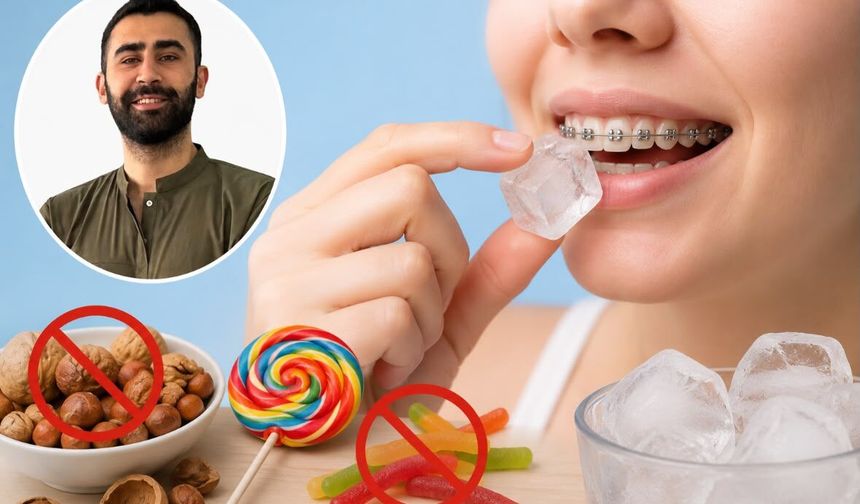 Yaz aylarında diş teli kullananlara beslenme uyarısı