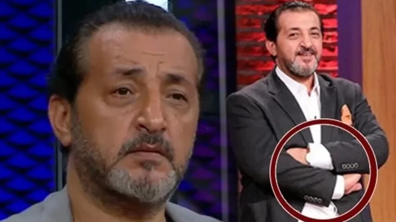 187 Mehmet Sefin Sol Eli Fotograflari Mehmet Sef Elini Nasil Kesti Ne Kazasi Gecirdi