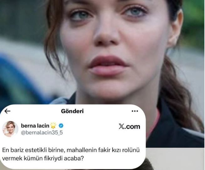 Berna Laçin, Sahtekarlar Dizisinde Hilal Altınbilek 'In Estetiklerini Eleştirdi