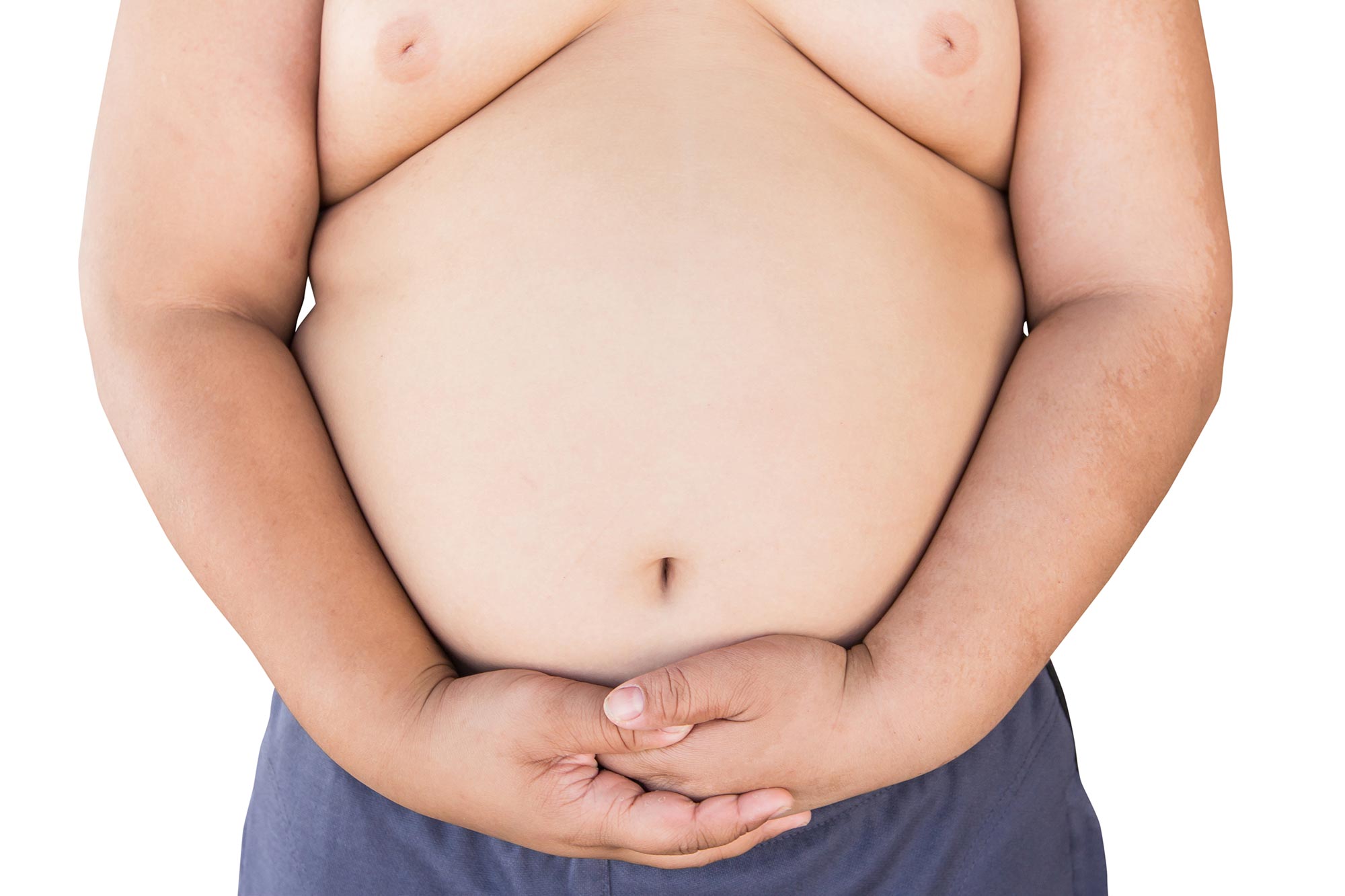 Overweight Child