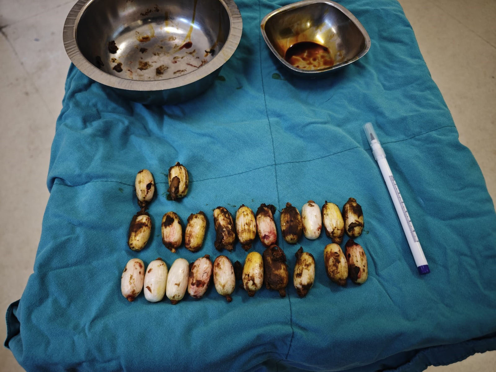 M I D E S I N D E N 44 K A P S U L U Y U S T U R U C U M A D D E B O 1113771 330649