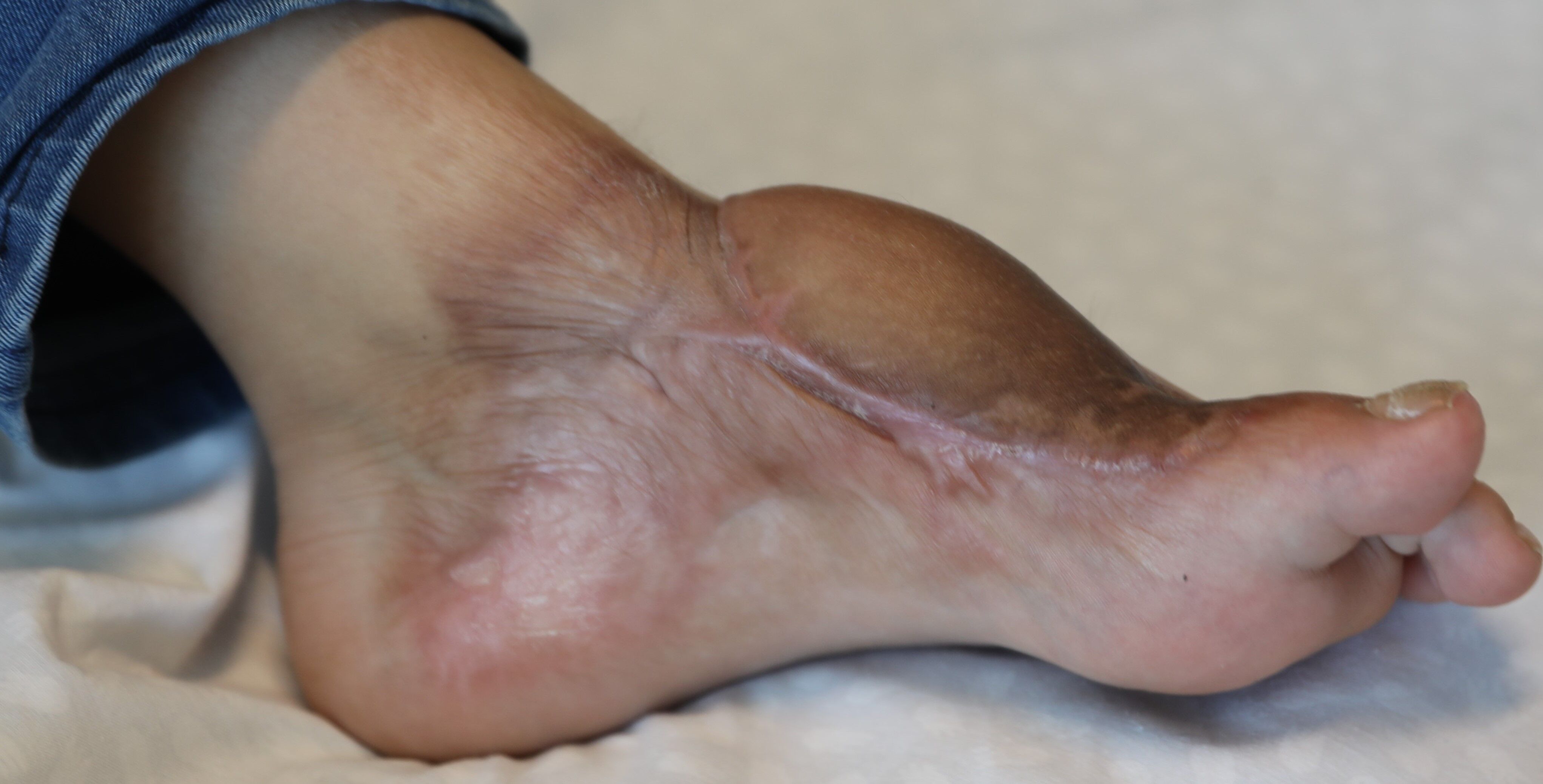 K A S I G I N D A N A L I N A N D O K U N A K L I Y L E A Y A K K A B I 1271007 378282