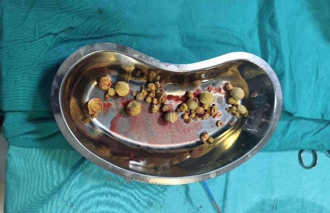 SAĞLIK